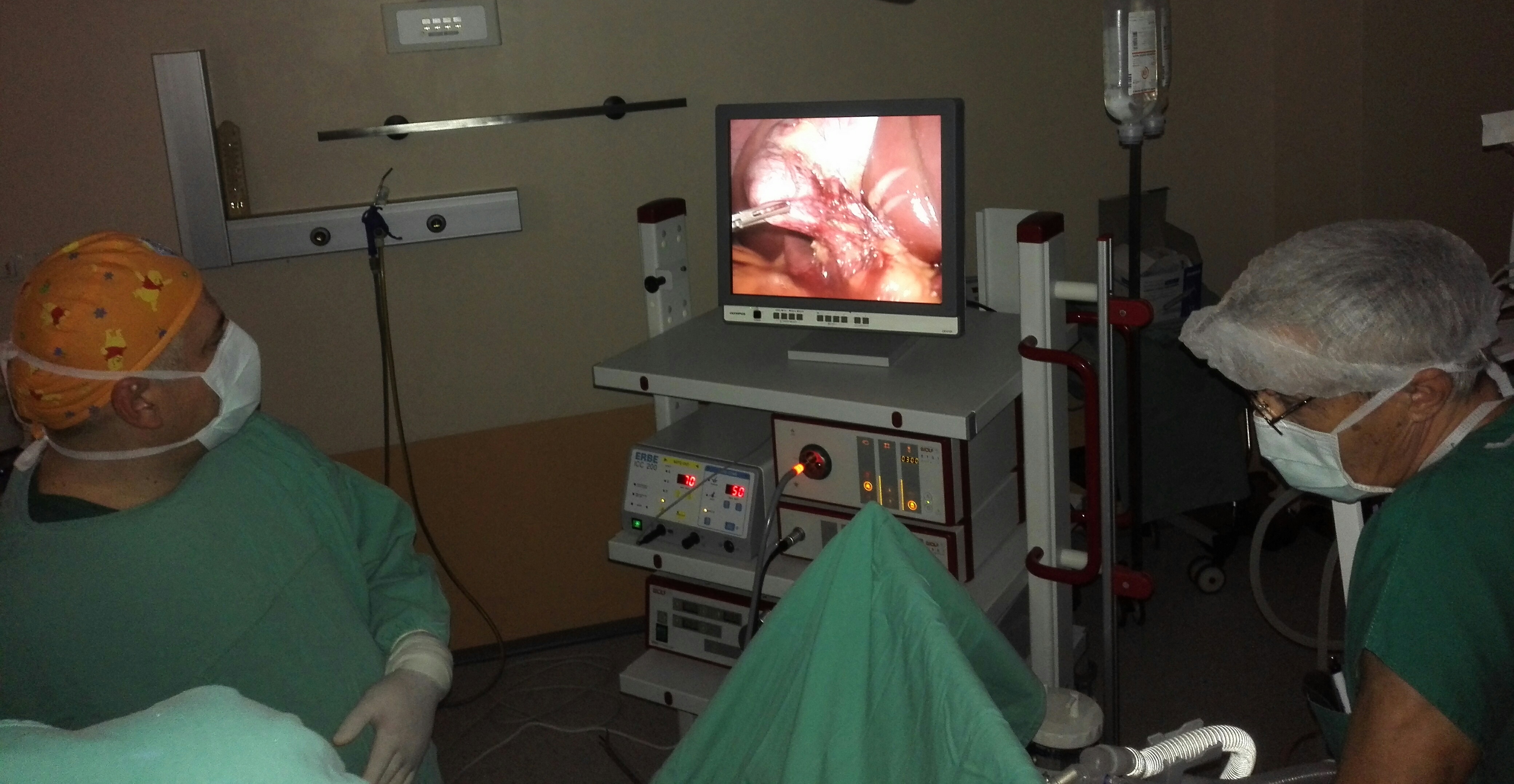 Prve laparoskopske operacije žučne kese